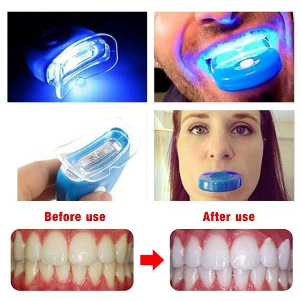 Teeth Whitening UV light + Tray to fit - MR White LTD